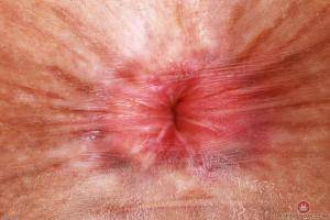 Original 3000 px/ 2000 px