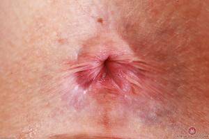 Original 3000 px/ 2000 px