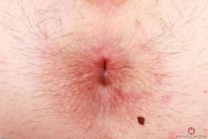 Original 3000 px/ 2000 px