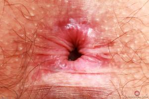 Original 3000 px/ 2000 px